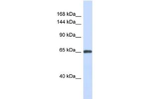 Host:  Rabbit  Target Name:  ZNF280D  Sample Type:  Fetal Brain lysates  Antibody Dilution:  1. (ZNF280D 抗体  (N-Term))