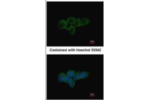 ICC/IF Image Immunofluorescence analysis of methanol-fixed A431, using LDHA, antibody at 1:500 dilution. (Lactate Dehydrogenase A 抗体)