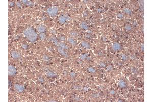 IHC analysis of GABA(A)R Beta 3 in frozen sections of mouse brain extract using GABRB3 antibody. (GABRB3 抗体  (AA 370-433))