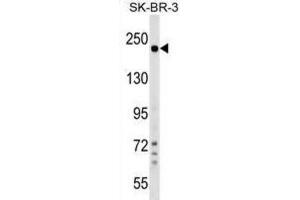 Western Blotting (WB) image for anti-Shroom Family Member 2 (SHROOM2) antibody (ABIN2999737) (SHROOM2 抗体)