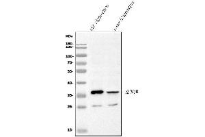 Western blot analysis of SCN1B using anti-SCN1B antibody (ABIN7600600).