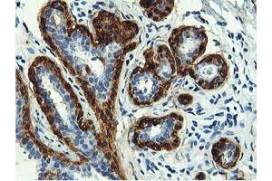Immunohistochemical staining of paraffin-embedded Human breast tissue using anti-TAGLN mouse monoclonal antibody. (Transgelin 抗体)