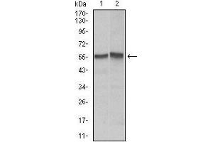 Western blot analysis using FAS mouse mAb against Hela (1), Jurkat (2) cell lysate. (FAS 抗体)