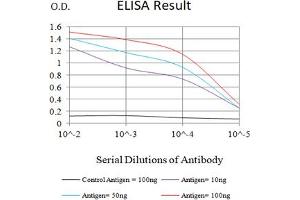 Black line: Control Antigen (100 ng),Purple line: Antigen (10 ng), Blue line: Antigen (50 ng), Red line:Antigen (100 ng) (GLUL 抗体  (AA 2-121))
