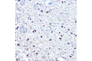 Immunohistochemistry of paraffin-embedded rat brain using Phospho-RB-S780 Rabbit pAb (ABIN3020471, ABIN3020472, ABIN3020473 and ABIN1681996) at dilution of 1:100 (40x lens). (Retinoblastoma 1 抗体  (pSer780))