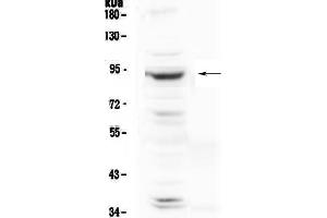 Western blot analysis of PLA2G6 using anti-PLA2G6 antibody . (PLA2G6 抗体  (AA 715-802))