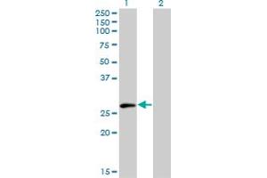 Western Blot analysis of ELF5 expression in transfected 293T cell line by ELF5 monoclonal antibody (M01), clone 3D10. (ELF5 抗体  (AA 166-263))