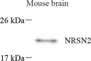 Western blot analysis of NRSN2 (ABIN7074806) at dilution of 1: 500 (NRSN2 抗体)