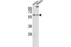 Western Blotting (WB) image for anti-Cryptochrome 2 (Photolyase-Like) (CRY2) antibody (ABIN3002520) (CRY2 抗体)