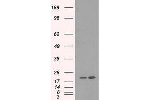 Image no. 5 for anti-Dihydrofolate Reductase (DHFR) antibody (ABIN1497822) (Dihydrofolate Reductase 抗体)