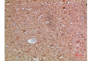 Immunohistochemical analysis of paraffin-embedded human-brain, antibody was diluted at 1:200 (ARTN 抗体  (AA 101-150))