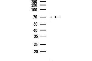 Western blot analysis of lysates from COLO205 cells(UV,30 min treatment), using GUSB Antibody at 1/1000 dilution.