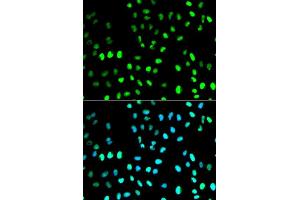 Immunofluorescence analysis of MCF7 cell using SUMO1 antibody. (SUMO1 抗体  (AA 1-101))