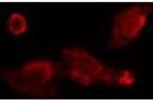 ABIN6275750 staining  Hela cells by IF/ICC. (BRE 抗体  (C-Term))