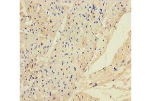 Immunohistochemistry of paraffin-embedded human heart tissue using ABIN7144104 at dilution of 1:100 (ANGPTL2 抗体  (AA 23-493))
