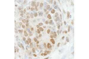 anti-Retinoblastoma Binding Protein 5 (RBBP5) (C-Term) antibody