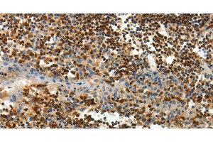 Immunohistochemistry of paraffin-embedded Human tonsil tissue using AMD1 Polyclonal Antibody at dilution 1:40 (AMD1 抗体)