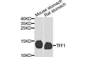 Western blot analysis of extracts of various cells, using TFF1 antibody.