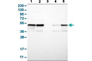 Western Blot analysis with PTPN1 polyclonal antibody . (PTPN1 抗体  (AA 268-406))