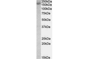 Western Blotting (WB) image for anti-Stromal Antigen 2 (STAG2) (Internal Region) antibody (ABIN2464858) (STAG2 抗体  (Internal Region))