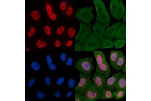 ABIN6256471 and ABIN6267557 staining Hela cells by IF/ICC. (Caspase 9 抗体  (pThr125))