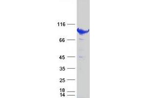 Western Blotting (WB) image for Signal Transducer and Activator of Transcription 5B (STAT5B) protein (Myc-DYKDDDDK Tag) (ABIN2732827)