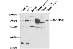 Western Blotting (WB) image for anti-Zinc Finger, MYND-Type Containing 11 (ZMYND11) (AA 278-567) antibody (ABIN6150457)