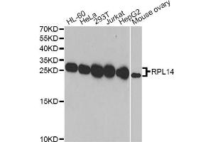 Western blot analysis of extracts of various cell lines, using RPL14 antibody (ABIN2559761) at 1:1000 dilution. (RPL14 抗体)
