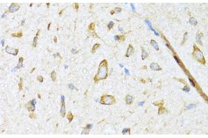 Immunohistochemistry of paraffin-embedded Mouse spinal cord using DNAJB11 Polyclonal Antibody at dilution of 1:100 (40x lens). (DNAJB11 抗体)