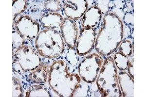 Immunohistochemical staining of paraffin-embedded Kidney tissue using anti-LIPG mouse monoclonal antibody. (LIPG 抗体)
