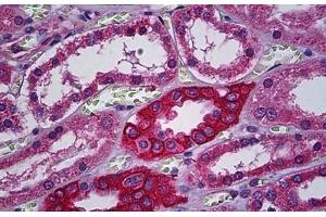 Immunohistochemistry (Formalin-fixed Paraffin-embedded Sections) (IHC (fp)) image for anti-Calcium Channel, Voltage-Dependent, alpha 2/delta Subunit 2 (CACNA2D2) (AA 65-163) antibody (ABIN790471)