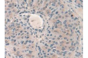 DAB staining on IHC-P; Samples: Mouse Ovary Tissue (HPS4 抗体  (AA 20-214))