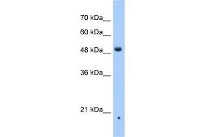 WB Suggested Anti-ZDHHC16 Antibody Titration:  0. (ZDHHC16 抗体  (N-Term))