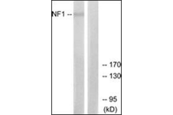 Neurofibromin 1 抗体  (Internal Region)