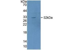 Detection of Recombinant SGK1, Mouse using Polyclonal Antibody to Serum/Glucocorticoid Regulated Kinase 1 (SGK1) (SGK1 抗体  (AA 145-386))