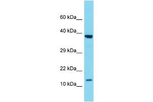 Western Blotting (WB) image for anti-Secretoglobin, Family 2A, Member 1 (SCGB2A1) (N-Term) antibody (ABIN2788420) (SCGB2A1 抗体  (N-Term))