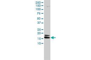 NME2 monoclonal antibody (M01), clone 4B7-3F12 Western Blot analysis of NME2 expression in Jurkat . (NME2 抗体  (AA 1-152))