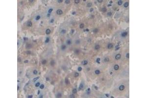 Used in DAB staining on fromalin fixed paraffin- embedded Kidney tissue (KNT1 (LOC100127401) (AA 367-430) 抗体)