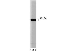 Western blot analysis of Eps8 on a lysate from mouse macrophages (RAW 264. (EPS8 抗体  (AA 628-821))