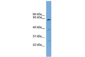 WB Suggested Anti-PSMD3 Antibody Titration: 0. (PSMD3 抗体  (Middle Region))