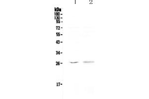 Western blot analysis of Kallikrein 6 using anti-Kallikrein 6 antibody . (Kallikrein 6 抗体  (AA 22-244))