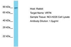 Image no. 1 for anti-Vertebrae Development Associated (VRTN) (AA 568-617) antibody (ABIN6750624) (VRTN 抗体  (AA 568-617))