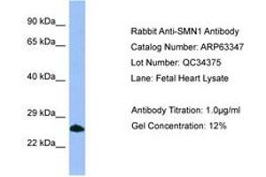 Image no. 1 for anti-Survival of Motor Neuron 1, Telomeric (SMN1) (C-Term) antibody (ABIN6749972) (SMN1 抗体  (C-Term))