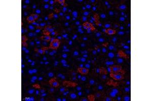 Immunofluorescence (Paraffin-embedded Sections) (IF (p)) image for anti-Aldehyde Dehydrogenase 4 Family, Member A1 (ALDH4A1) antibody (ABIN7073000)