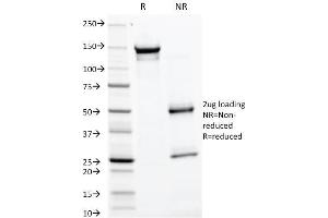 SDS-PAGE Analysis Purified GP2 Mouse Monoclonal Antibody (GP2/1805). (GP2 抗体  (AA 35-179))