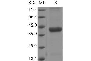 Cathepsin H (CTSH) (AA 21-333) protein (His tag)