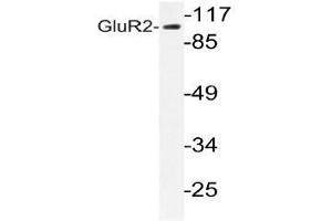 Western blot analysis of GluR2 antibody in extracts from HUVEC cells. (GRIA2 抗体)