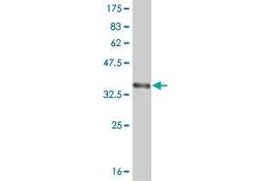 Western Blot detection against Immunogen (36. (ABL2 抗体  (AA 743-842))