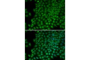 Immunofluorescence (IF) image for anti-Polymerase (RNA) I Polypeptide C, 30kDa (POLR1C) (AA 1-200) antibody (ABIN3020841)
