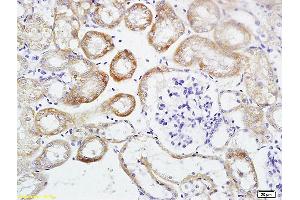 Formalin-fixed and paraffin embedded mouse kidney tissue labeled with Anti HSD11B2 Polyclonal Antibody, Unconjugated (ABIN701680) at 1:200 followed by conjugation to the secondary antibody and DAB staining (HSD11B2 抗体  (AA 151-250))